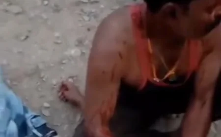 अजमेर में रास्ते के विवाद ने लिया खूनी रूप: कुल्हाड़ी से हमला, पिता-पुत्र गंभीर रूप से घायल; हमलावर बाइक सवार होकर फरार, पुलिस ने शुरू की जांच