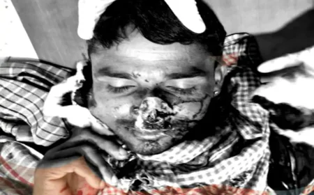 बाड़मेर में लव मैरिज से उपजा पुराना विवाद: जेठ की नाक काटी, जवाब में चाचा का पैर तोड़ा