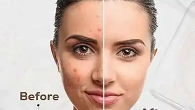 अपनी त्वचा के अनुसार सही क्लीन्ज़र चुनें: स्वस्थ और चमकदार स्किन के लिए जरूरी स्किनकेयर टिप्स