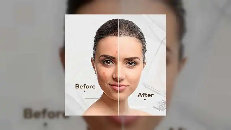 अपनी त्वचा के अनुसार सही क्लीन्ज़र चुनें: स्वस्थ और चमकदार स्किन के लिए जरूरी स्किनकेयर टिप्स